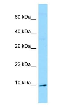 Polyclonal Rabbit anti-Human OLFM1 Antibody (C-Terminus, WB)