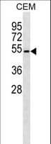 B4GALT4 Antibody (aa91-117)