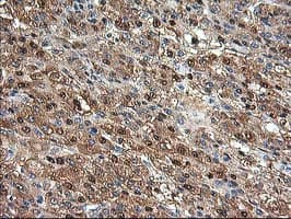 ACY1 / Aminoacylase 1 Antibody (clone OTI1D4)