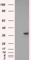 DNTTIP1 / TDIF1 Antibody (clone OTI1D3)