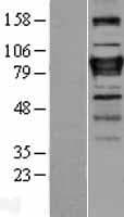 Human ZNF408 / PRDM17 Protein (Over-Expression Lysate Myc-DDK (Flag))