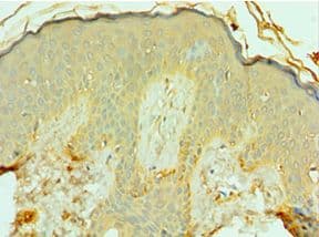 FRA-1 / FOSL1 Antibody (aa1-100)