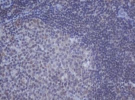 Monoclonal Mouse anti-Human DDX59 Antibody (clone OTI2G1, IHC, WB)