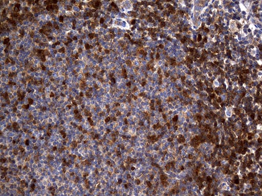 GALM / Mutarotase Antibody (clone OTI4F4)