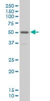 PKNOX1 / PREP1 Antibody (clone 4F6)