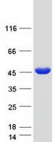 Human TPM2 Protein (Recombinant Myc-DDK (Flag))