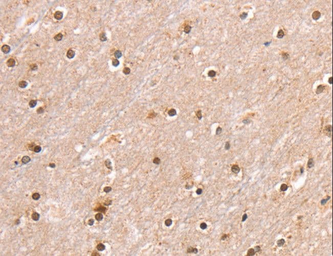 Polyclonal Rabbit anti-Human SMARCB1 / INI1 Antibody (IHC, WB)