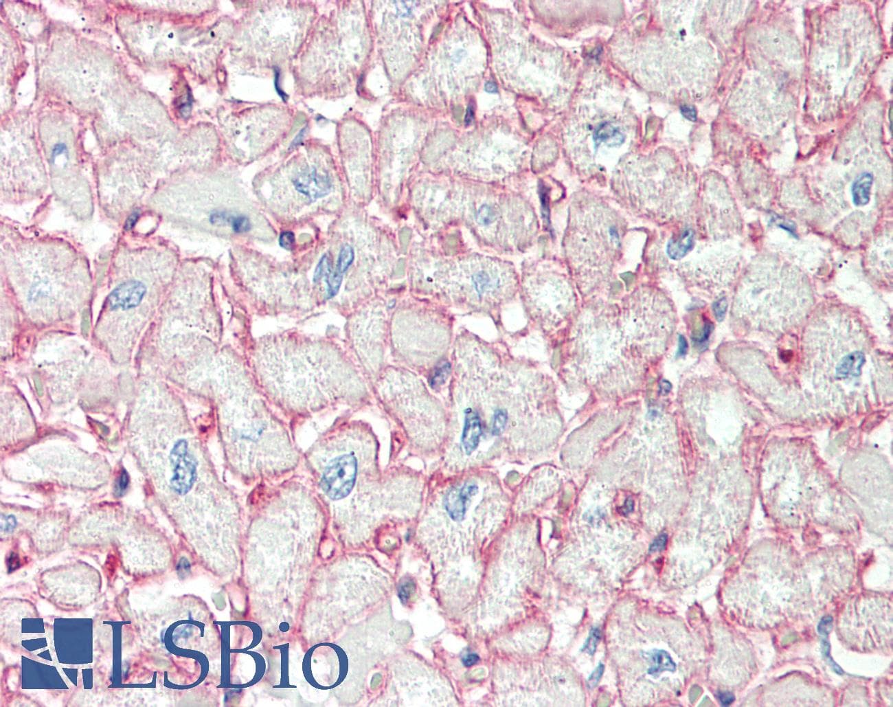 CAV1 / Caveolin 1 Antibody (aa2-104)
