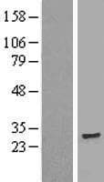 TMEM186 Protein (Over-Expression Lysate Myc-DDK (Flag))