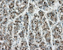 Monoclonal Mouse anti-Human ERCC1 Antibody (clone OTI2E11, IHC, IF, WB)