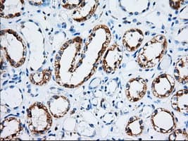 IGF2BP2 Antibody (clone OTI5G3)