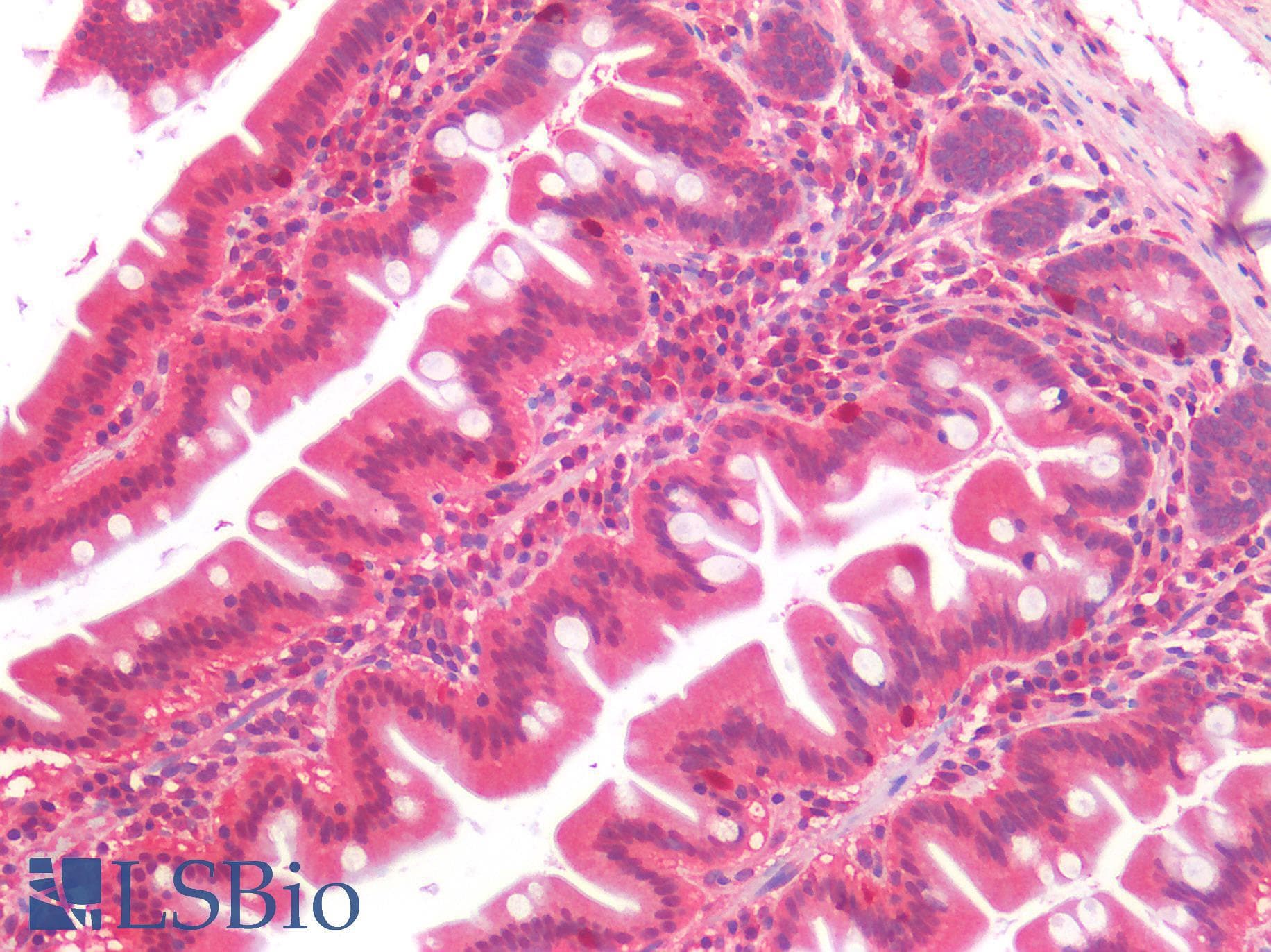 IHC-plus™ ALK2 / ACVR1 Antibody