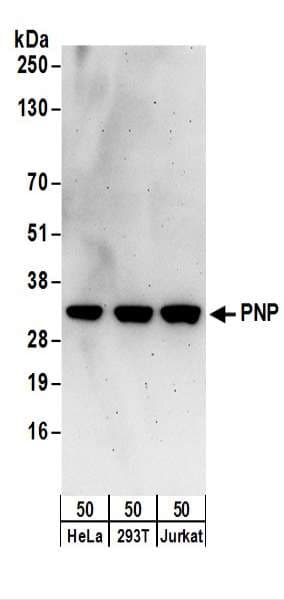 IHC-plus™ Polyclonal Rabbit anti-Human PNP / Nucleoside Phosphorylase Antibody (aa239-289, IHC, WB)