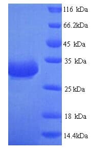 E. coli Beta-Lactamase CTX-M-1 Protein (Recombinant His)