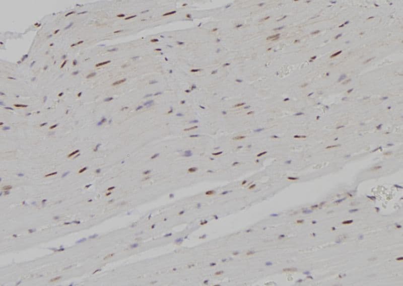 AML1 / RUNX1 Antibody (phospho-Ser303)