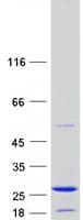 Human ZMAT5 Protein (Recombinant Myc-DDK (Flag))