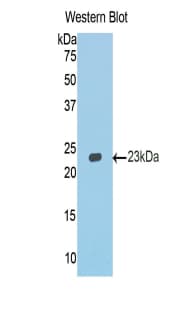 CDH1 / E Cadherin Antibody (aa751-884, Cy3)