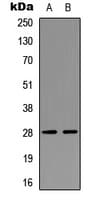 Polyclonal Rabbit anti-Human NPDC1 Antibody (Internal, IHC, WB)