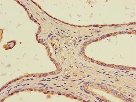 Polyclonal Rabbit anti-Human TLL1 Antibody (IHC, IF)
