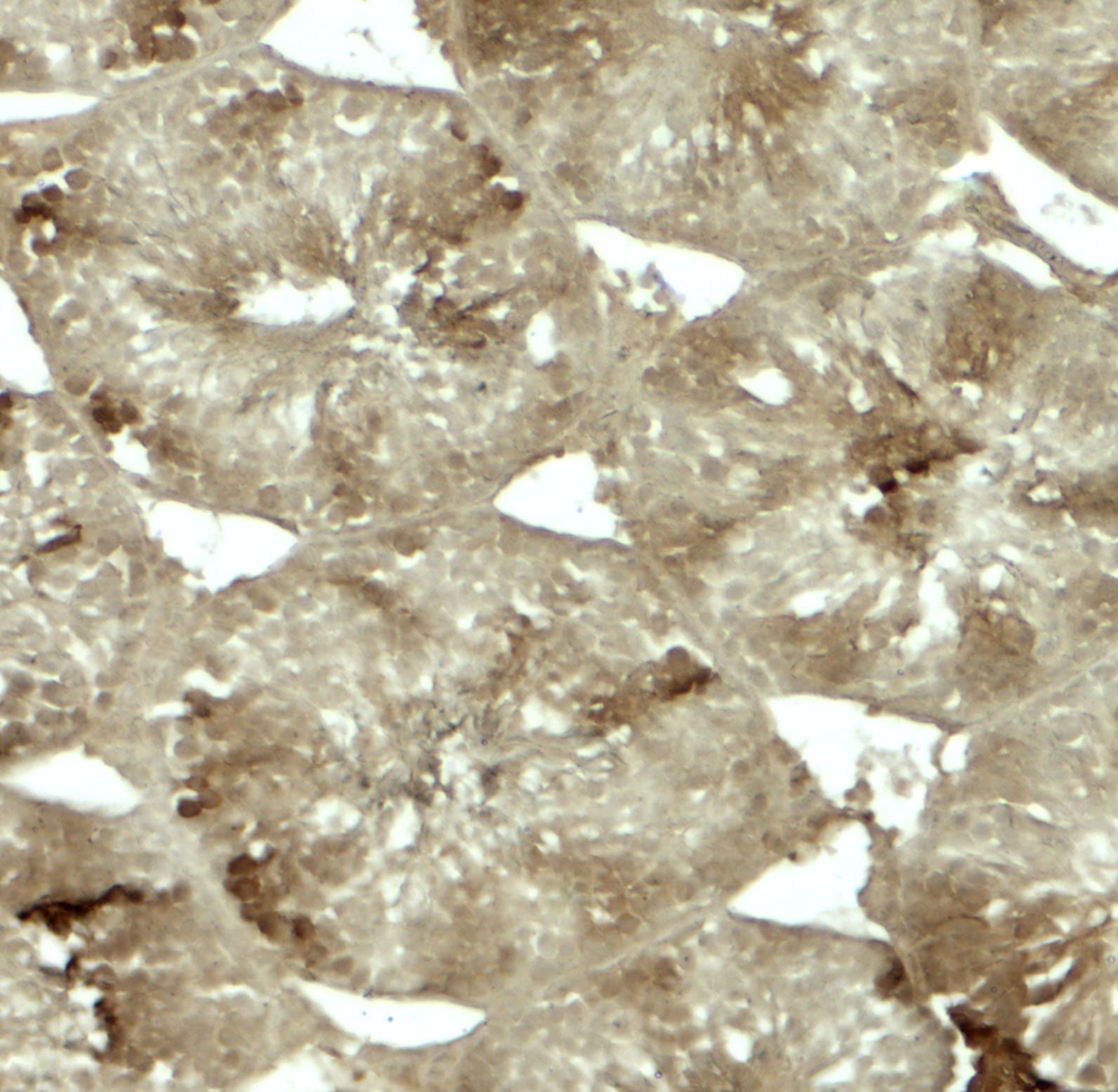 CRBN / Cereblon Antibody