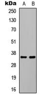 C/EBP Beta / CEBPB Antibody (phospho-Thr235)