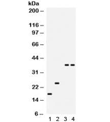 Polyclonal Rabbit anti-Human PLN / Phospholamban Antibody (WB)