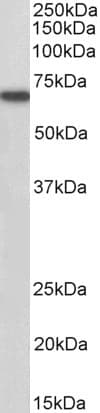 IHC-plus™ Polyclonal Goat anti-Human MTM1 / Myotubularin Antibody (aa590-603, IHC, WB)