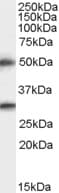 IHC-plus™ TMPRSS5 Antibody (aa413-425)