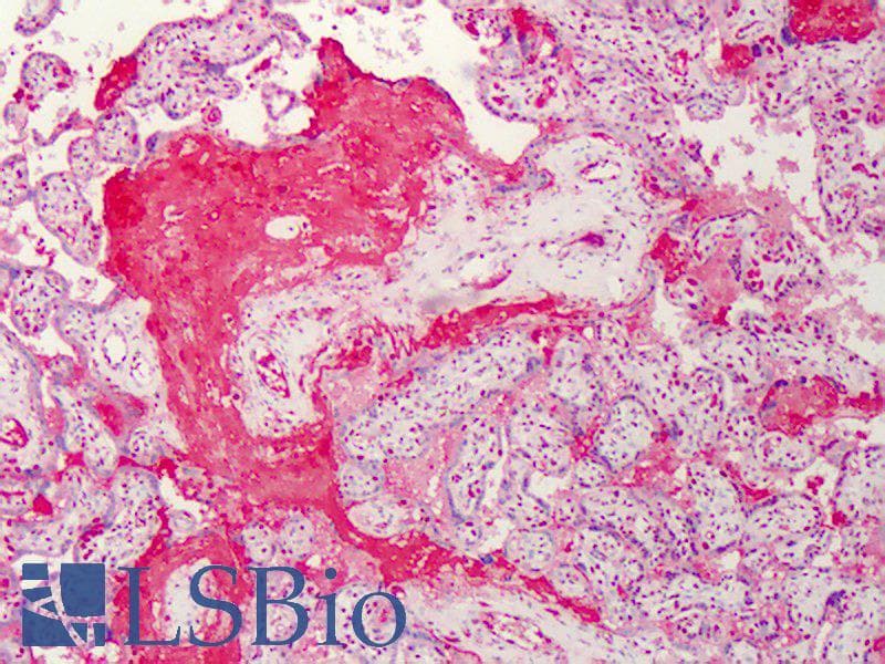 IHC-plus™ Polyclonal Rabbit anti-Human C1QTNF7 / CTRP7 Antibody (IHC, WB)