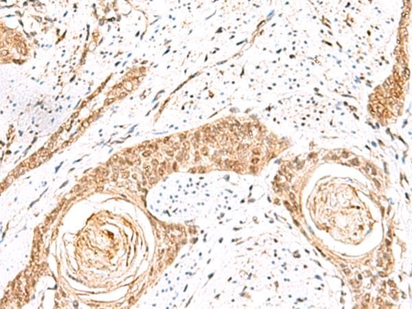 ELF3 / ESE1 Antibody