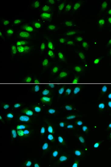Polyclonal Rabbit anti-Human PAX3 Antibody (IHC, IF, WB)