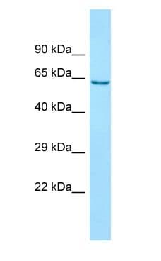ANKFY1 Antibody (aa429-469)