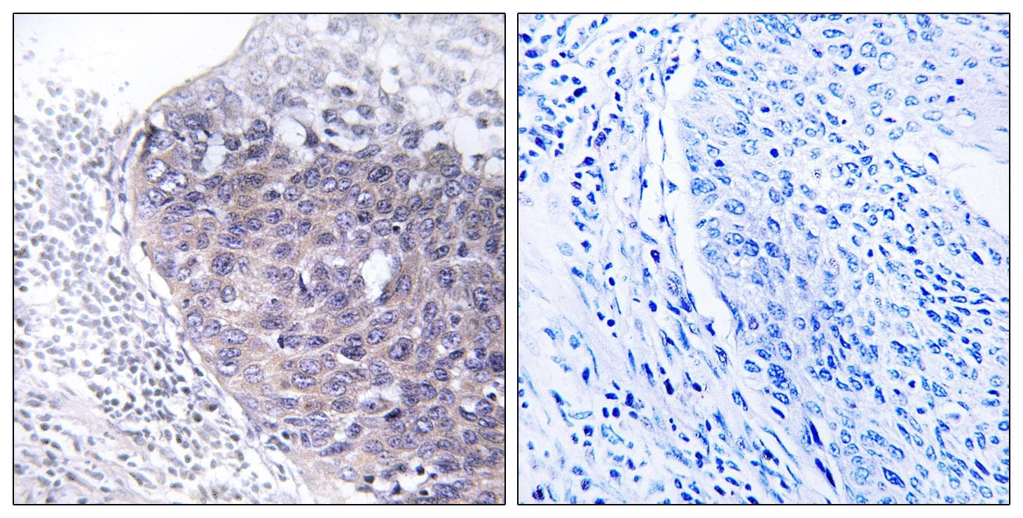 MTG2 / GTPBP5 Antibody