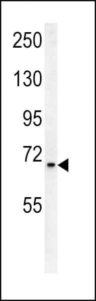 Polyclonal Rabbit anti-Human SLC25A12 / ARALAR Antibody (aa1-30, IHC, WB)