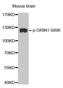 GRIN1 / NMDAR1 Antibody (phospho-Ser896)