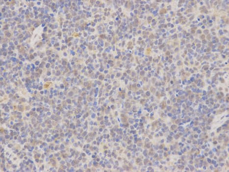 Polyclonal Rabbit anti-Human MAP2K7 / MEK7 Antibody (IHC, IF, WB)