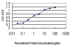 IHC-plus™ Monoclonal Mouse anti-Human CRIM1 Antibody (clone 6E4, IHC, WB)