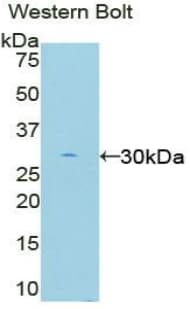 EIF2AK2 / PKR Antibody (aa279-506, Biotin)