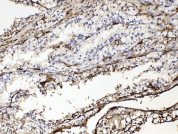 Polyclonal Rabbit anti-Human HBA1+2 / Hemoglobin Alpha Antibody (IHC, WB)