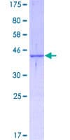 Human SH2D1A / SAP Protein (Recombinant GST)