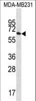 GBP1 Antibody (aa141-170)