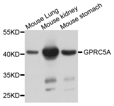 GPRC5A / RAI3 Antibody