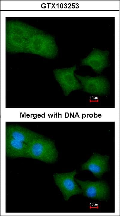 ARHGAP4 Antibody (aa1-280)