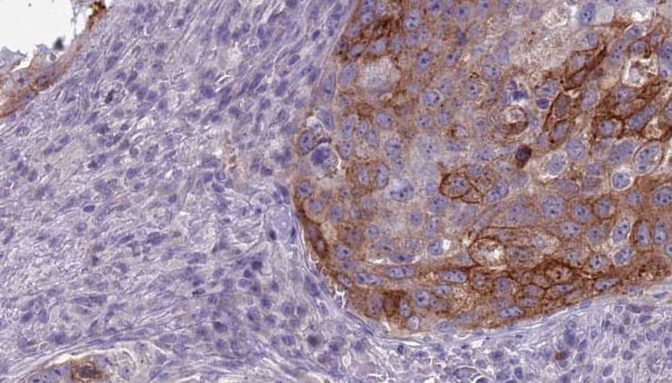 GNAL Antibody