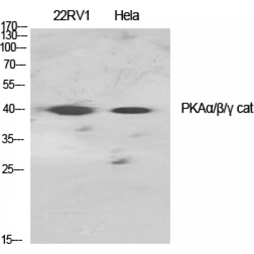 PRKACA + PRKACB + PRKACG Antibody (140-220 aa)