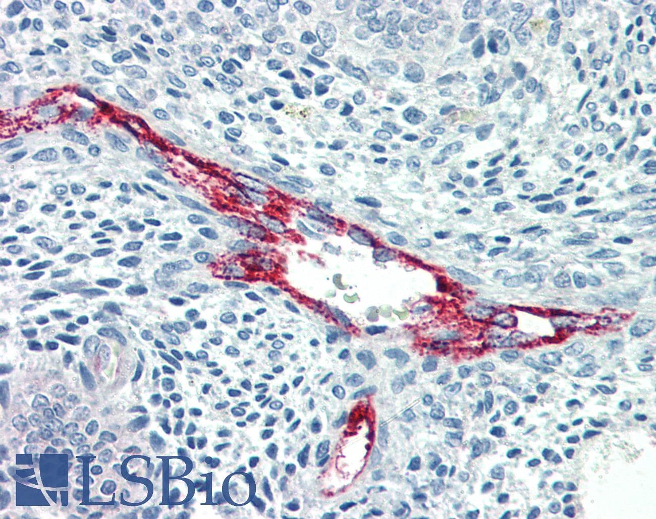 PathPlus™ Monoclonal Mouse anti-Human F8 / FVIII / Factor VIII Antibody (clone F8 2.2.9, IHC, WB)