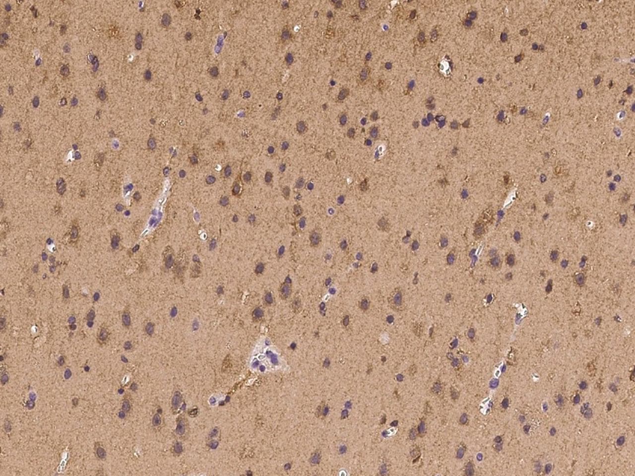 Polyclonal Rabbit anti-Human LRRC4C Antibody (IHC)