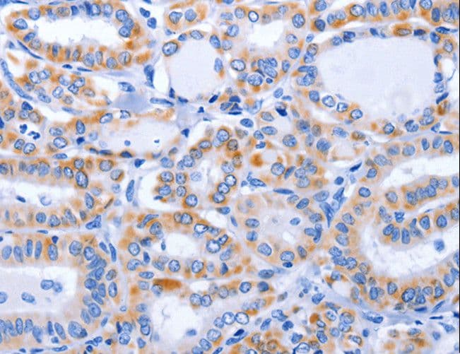 Polyclonal Rabbit anti-Human GFER Antibody (IHC, WB)