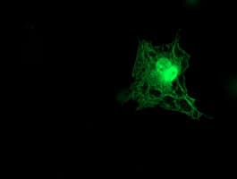 TMOD1 / Tropomodulin 1 Antibody (clone OTI2C2)