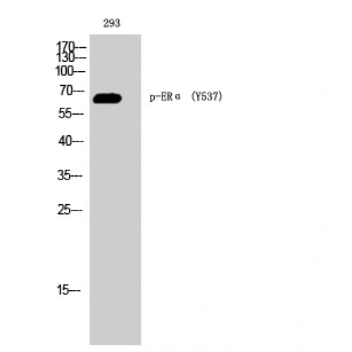Polyclonal Rabbit anti-Human ER Alpha / Estrogen Receptor Antibody (470-550 aa, IHC, WB)